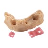  BASF Resina Ultracur3D DM 2304 - Gingiva Mask 1kg